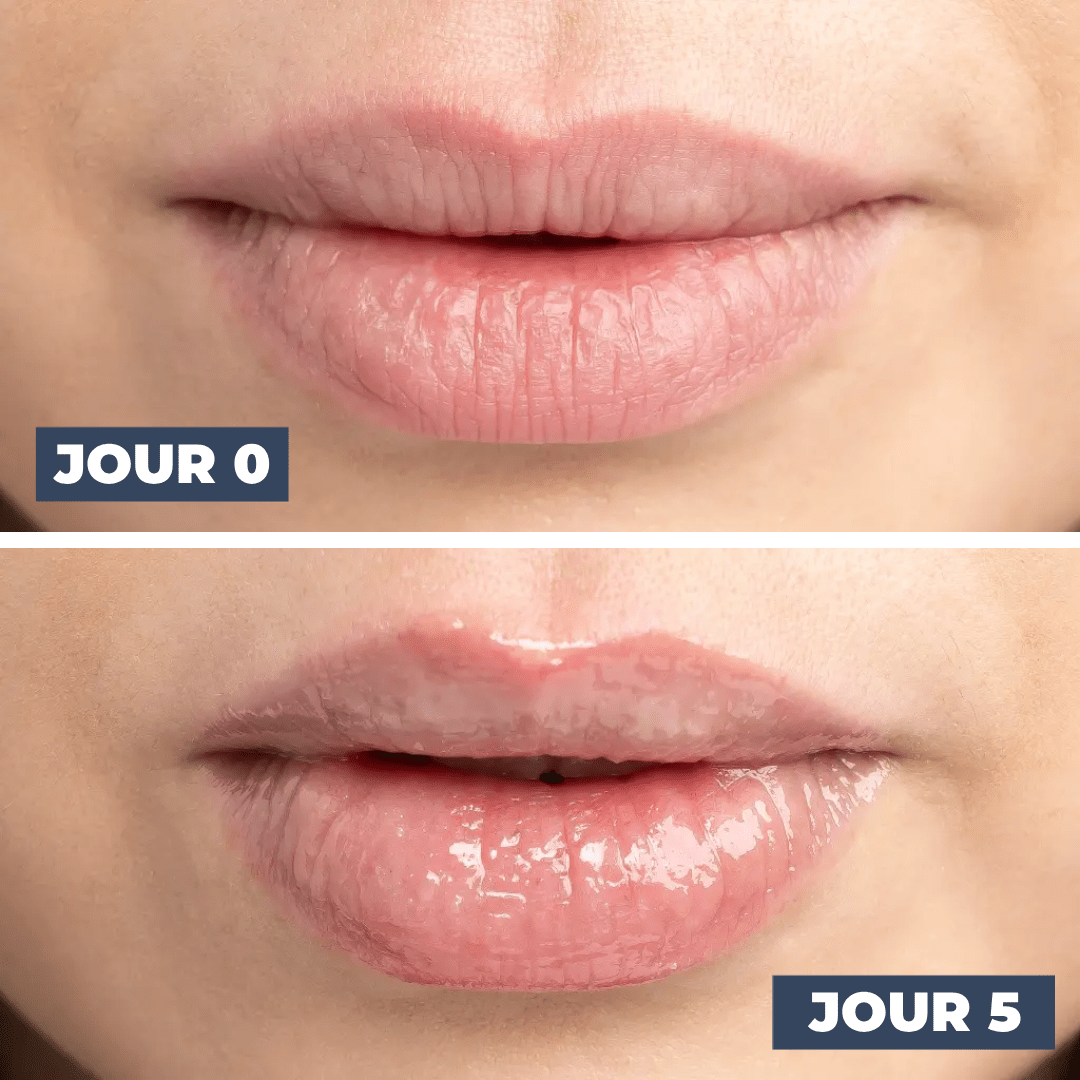 BAUME À LÈVRES RÉGÉNÉRANT - DISLE COSMÉTIQUES