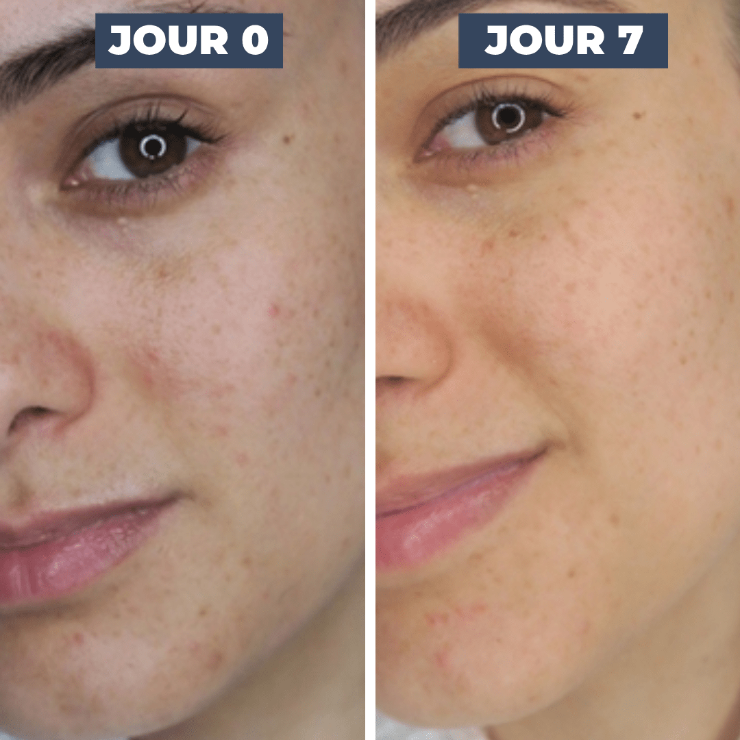 SÉRUM VITALITÉ 3 - 6 - 9 - DISLE COSMÉTIQUES