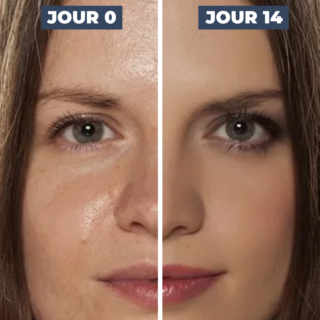 GEL VISAGE PEAU GRASSE