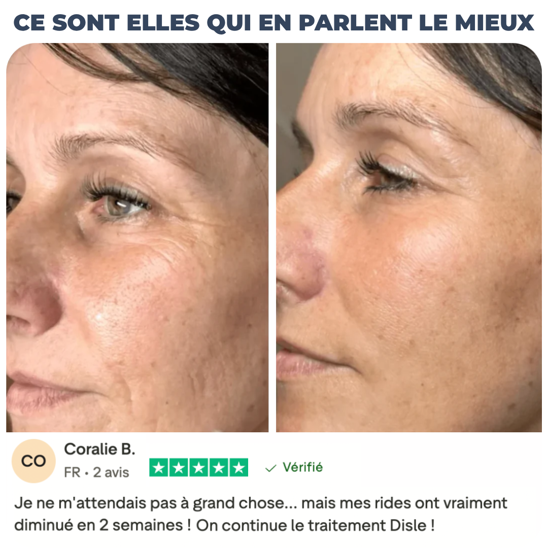 SÉRUM CIBLÉ ANTI-ÂGE - ROLL-ON