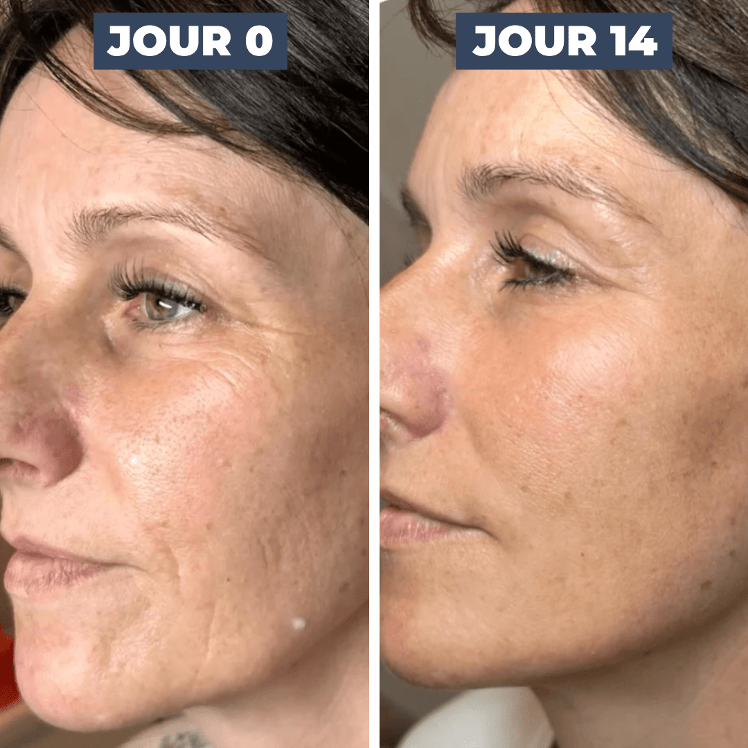 SÉRUM CIBLÉ ANTI - ÂGE - ROLL - ON - DISLE COSMÉTIQUES